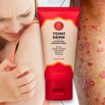 yenki derm Creme Deutschland Österreich Schweiz Preis Bewertungen