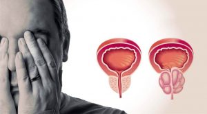 Jak chránit prostatu před hyperplazií a prostatitidou: bylinky, potraviny a další metody práce