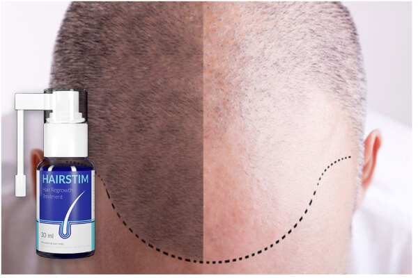 hairstim spray results, hair loss