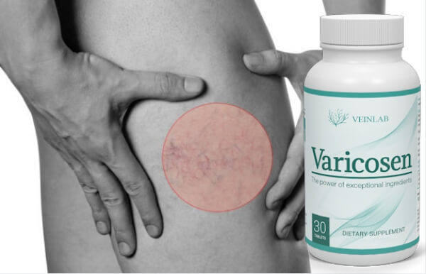 Tratamentul urinei varicoseza - varilogic.ro