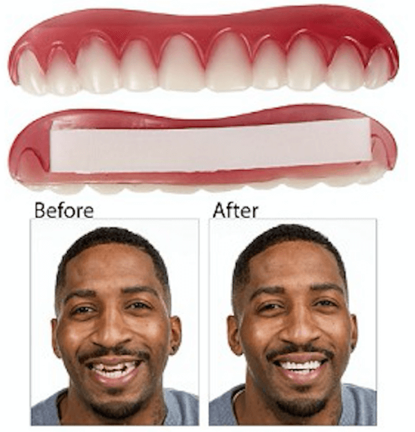 Easy Smile Veneers Review | Bright Up Your Smile