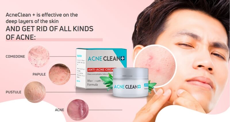 Acneclean + cream Review, opinions, price, usage, effects, Malaysia