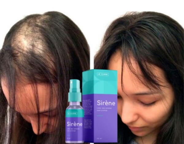 hair loss, hair growing spray