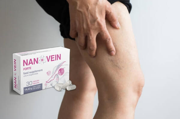 What Are Varicose Veins (Varices) 