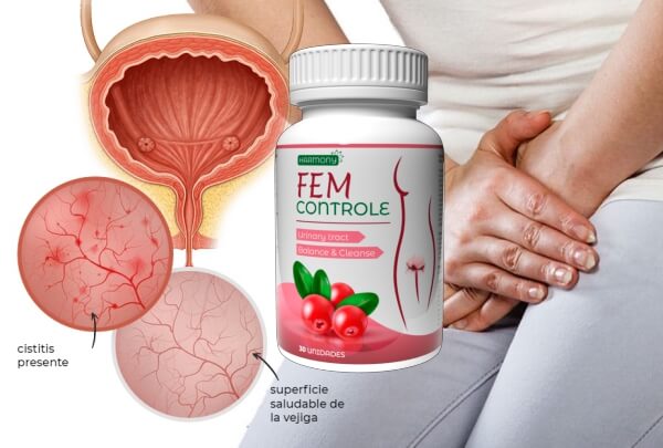 What is FEM Controle