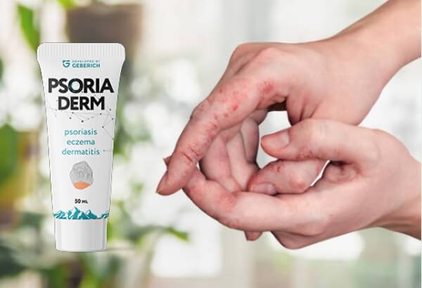 What Is PsoriaDerm