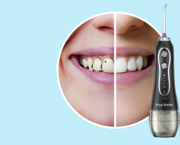 What Is PuurSmile Water Flosser 