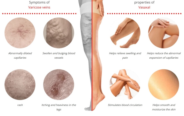  Varicose Veins and Radiant Skin